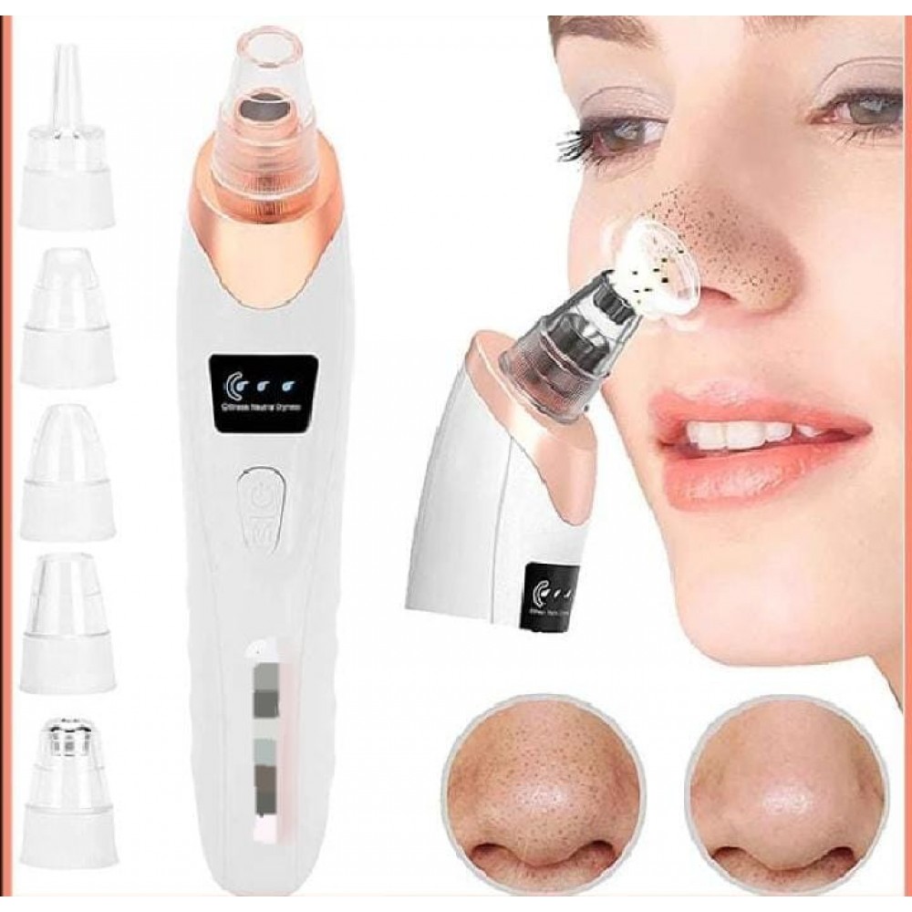 Blackhead Remover