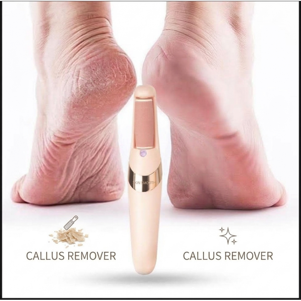 Rechargeable Electric Foot File